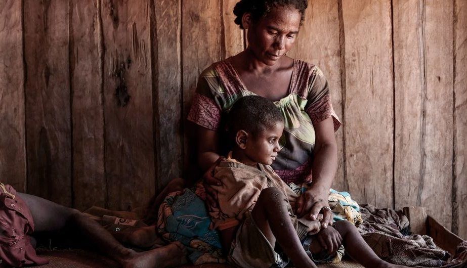 ЮНИСЕФ: Для спасения детей от голодной смерти нужны средства